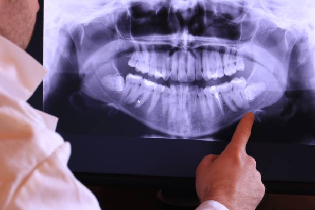 Best Emergency Dental Care for Trauma or Injury in Joseph City, AZ