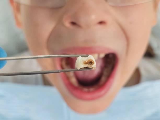 Best Pediatric Emergency Dentist in Joseph City, AZ